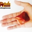 ที่นวดฝ่ามือ ( สี่เหลี่ยม )